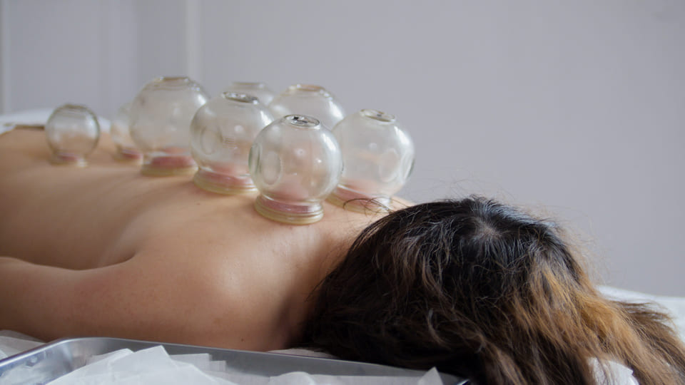 Tratamiento Comprehensivo y puncion seca